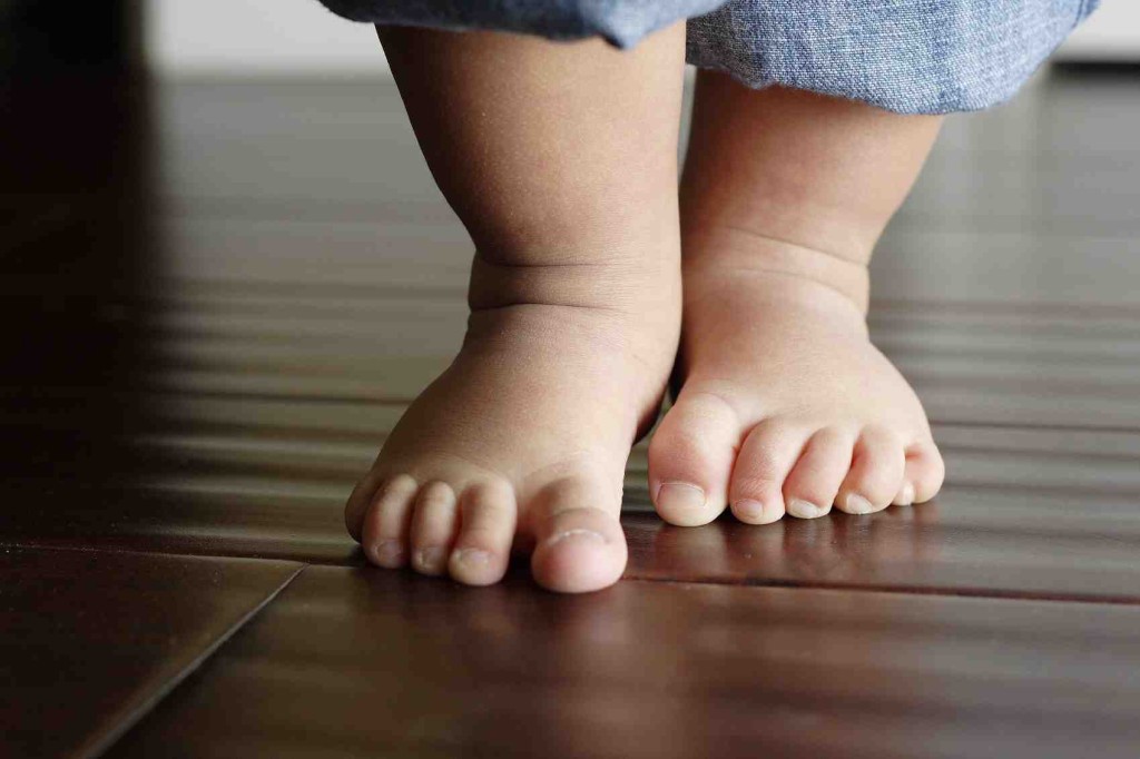 Flat Feet May Need Attention flat feet in children may need attention